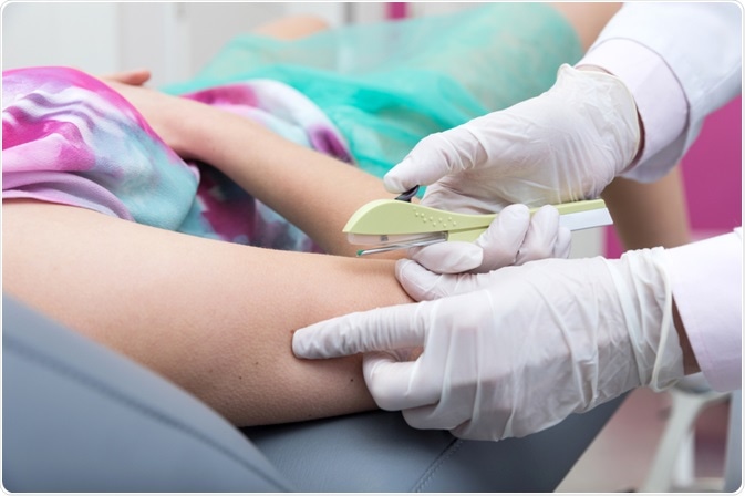 Pacatuba coloca o contraceptivo  Implanon na Rede Municipal de Saúde